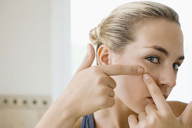 روش‌های درمان خانگی جوش صورت، درمان قطعی جوش صورت، بهترین داروی جوش صورت ، از بین بردن جوش های صورت با تغذیه مناسب!